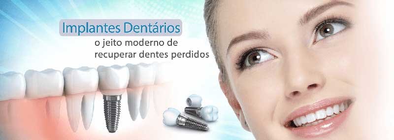 implante dentário titânio pino cerâmica valor preço parafuso endoósseo all on four overdenture subperiosteal zigomático balneário camboriú bc clínica